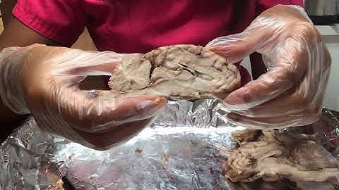 sheep brain dissection pt.2