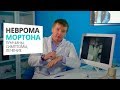 Неврома Мортона. Что это такое. Симтомы. Лечение. Врач Алексей Оленйник. Footclinic