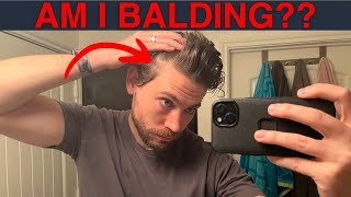 How to SPOT Early Signs of Balding (Catch Androgenic Alopecia FAST)