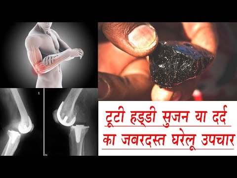 हड्डी फ्रैक्चर या हड्डी का खिसकना(disloction)कारण लक्षण और उपचार