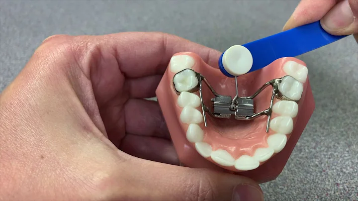 How to Turn Your Expander