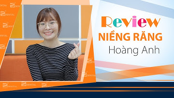 [Review niềng răng]: #217 Kết quả niềng răng của Hoàng Oanh