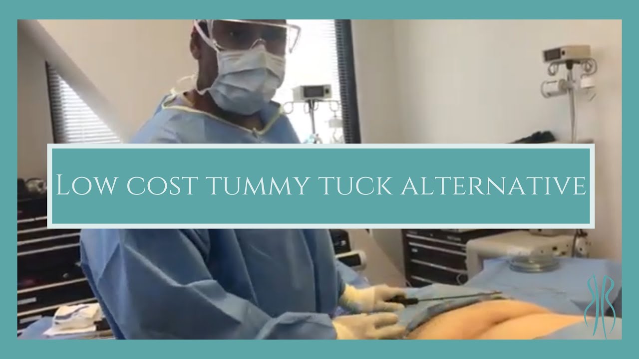 Low Cost Tummy Tuck Alternative YouTube Low Cost Tummy Tuck Alternative YouTube