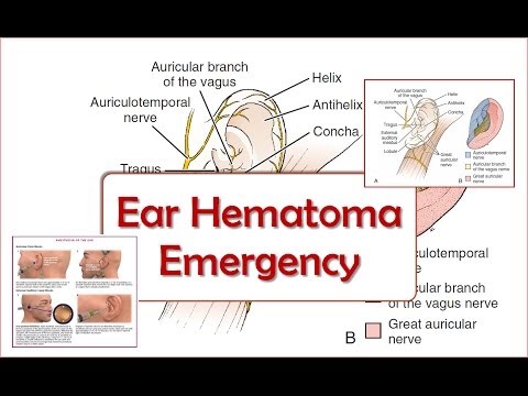 Video: Hemotomi u ušima u pasa