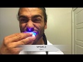 Dash Smiles vs MySmile Review (Home-Care Teeth Whitening Treatment)
