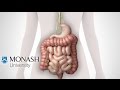 Ibs symptoms the low fodmap diet and the monash app that can help