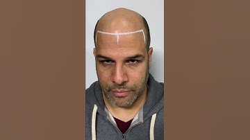 Part#2 the Before video SMP