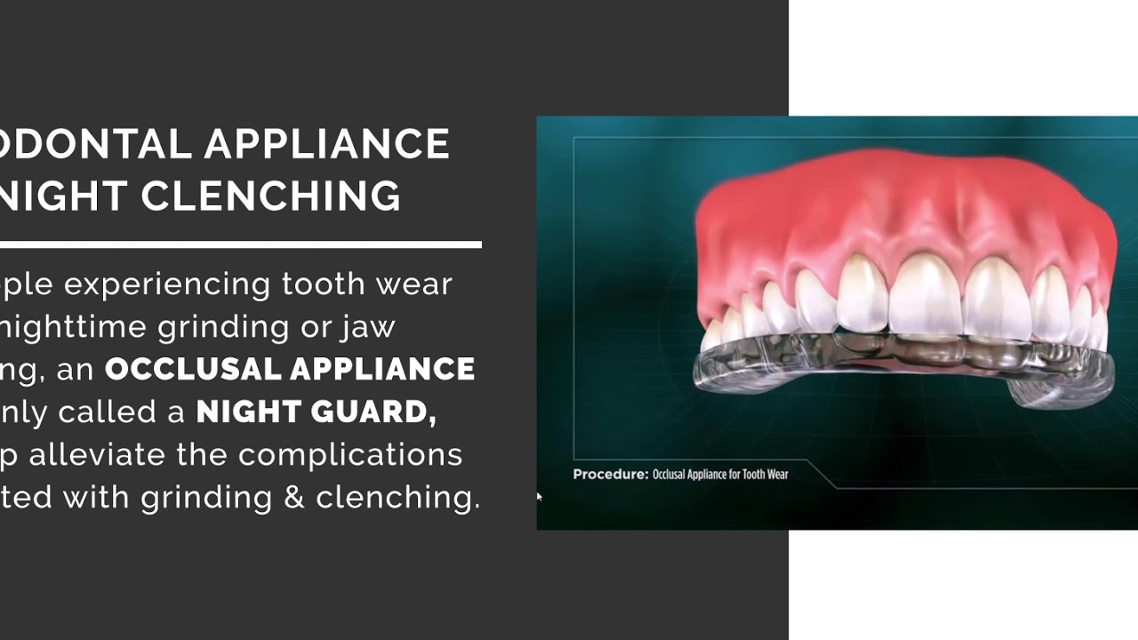 Perio Appliance Feb25 2020 YouTube