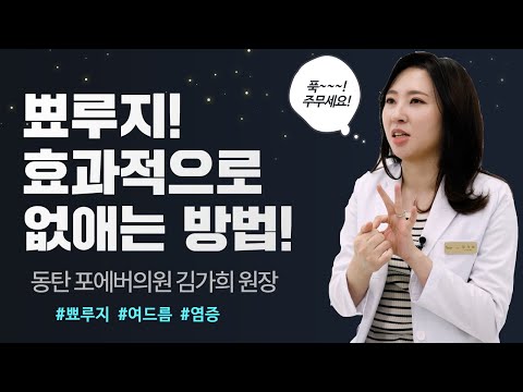 흉터 안남게 제거하는 뾰루지! 손으로 짜도 되나? 원인 | 흉터 | 여드름 | 염증 | 치료