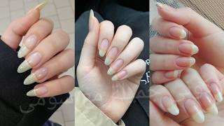 The Fastest Magic Recipe to Strengthen and Grow Nails Fast: Apply for 3 Days for Long, White, and... screenshot 2