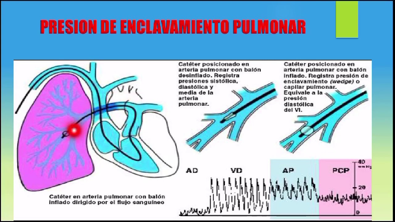 Circulación Pulmonar YouTube
