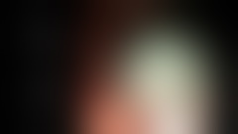 En-bloc EMR of a Large Right Colonic Serrated Lesion