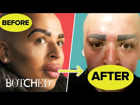 the-most-insane-lip-surgeries-|-botched-|-e!