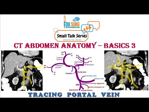 Portal vein anatomy on CT scan - learn CT abdomen - radiology made easy - anatomy masterclass