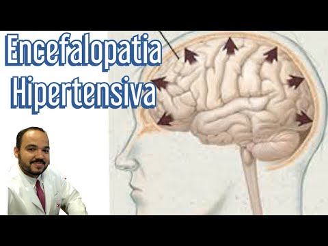 Vídeo: Encefalopatia Hipertensiva Do Cérebro: O Que é, Tratamento