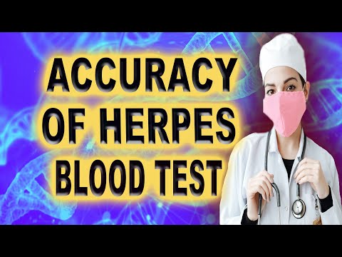 accuracy of herpes blood test