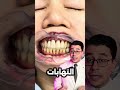 اقوى طريقة طبيعية لتنظيف الفم والاسنان