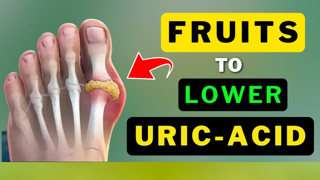 BEST FRUITS TO LOWER URIC ACID NATURALLY YouTube BEST FRUITS TO LOWER URIC ACID NATURALLY YouTube