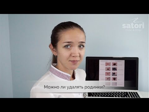 Родинки – как вовремя распознать меланому | удаление родинок Самара | дерматолог влог