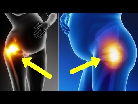 cure-joint-pain-during-pregnancy-[naturally]