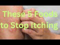 Top 5 foods that helps to eliminate itchness according to studies