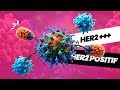 HER2 POSITIF Comprendre Ce Cancer Du Sein Qui Se Guérit Très Bien mp3