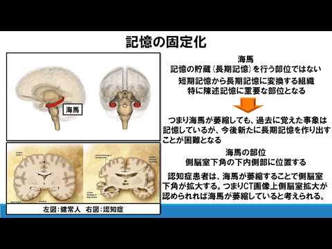 No15.脳シリーズ　理学療法士が解説する陳述記憶における短期記憶と長期記憶