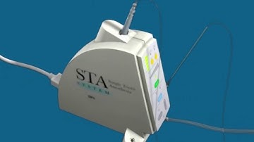 The Wand® STA Instrument - Overview