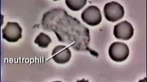 Neutrophil Phagocytosis - White Blood Cell Eats Staphylococcus Aureus Bacteria