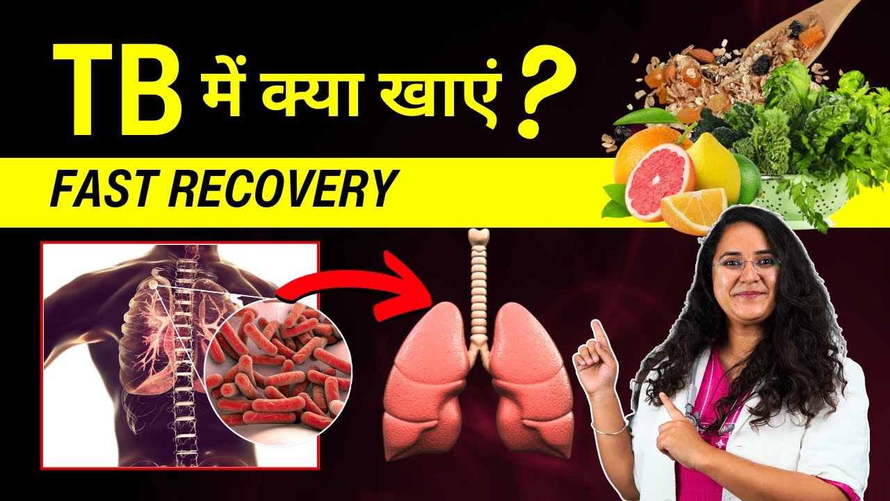 TB Me Kya Khana Chahiye? TB Diet Chart In Hindi YouTube