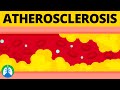 Atherosclerosis (Medical Definition) | Quick Explainer Video
