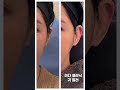 하루에 연예인 1분 씩 해 드리고 있는 시술
