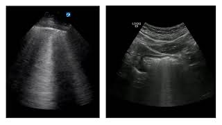 Reverberation and Mirror Image Artifacts Content