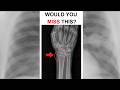 Start Here: Chest X-ray OSCE Guide for Radiography Students