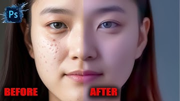 How to Remove Acne | Photoshop Tutorial For Beginners 2025 | Remove Acne Smooth Skin |