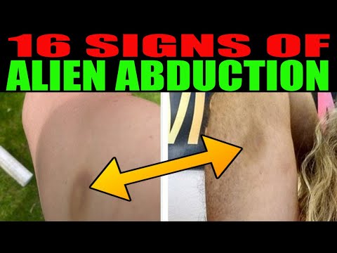 Alien Abduction 16 Signs You May Have Been Abducted by Extraterrestrials!