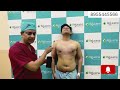 NON-SURGICAL ways to get RID of GYNECOMASTIA | Gynecomastia Patient Review |