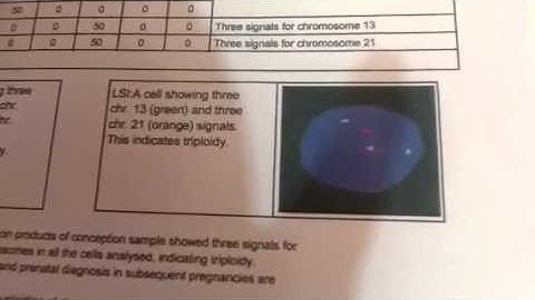 Triploidy after recurrent miscarriage with donor sperm IUI | what causes miscarriages