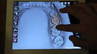 3D model in SimplyCeph App