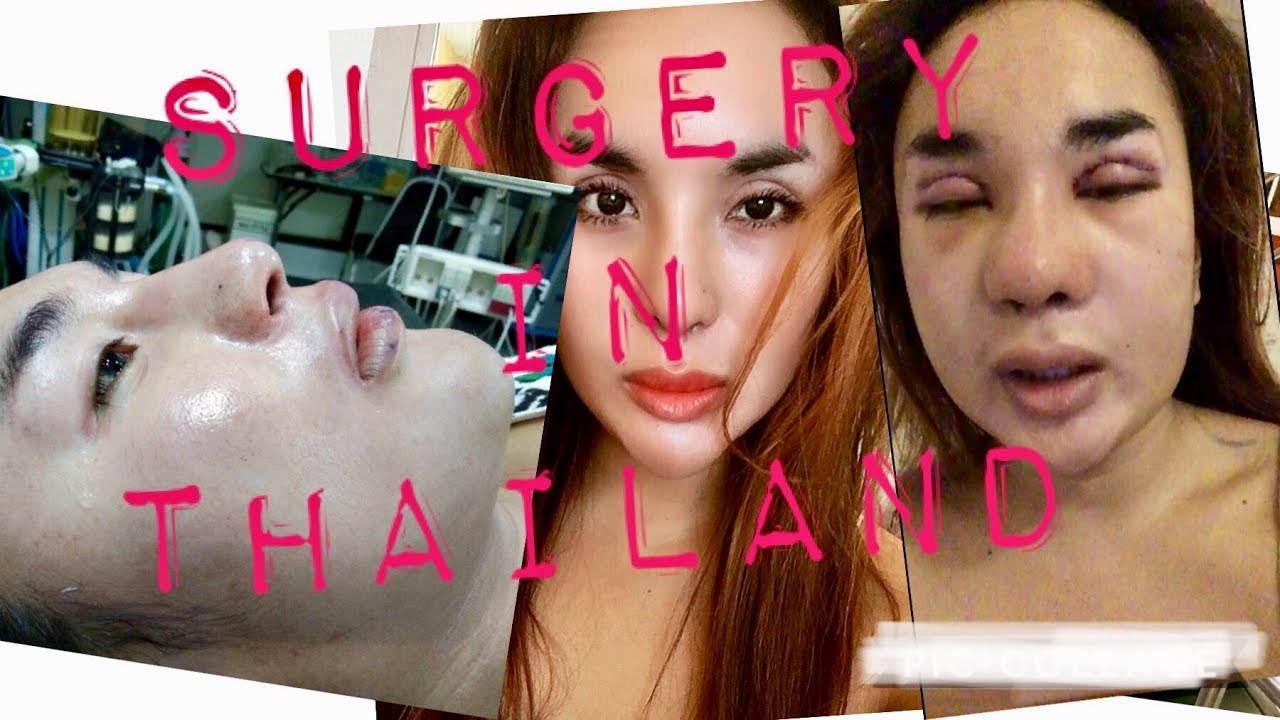 Plastic Surgery in Thailand YouTube