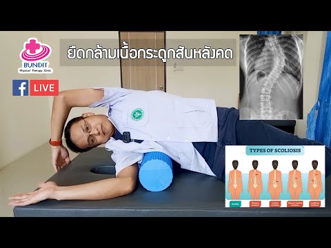 วีดีโอ: 3 วิธีในการทำแบบฝึกหัดการรักษากระดูกสันหลังคด