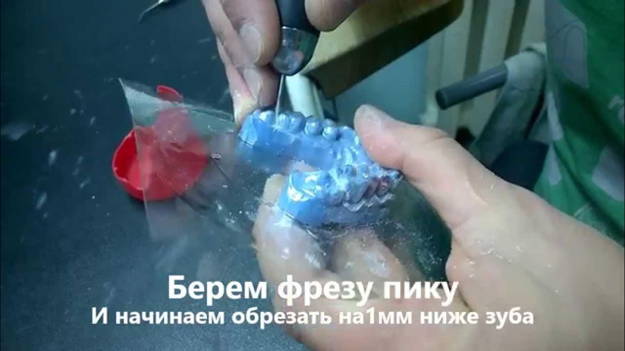 изготовление каппы для отбеливания - YouTube