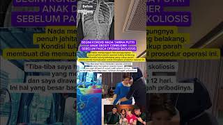 Kondisi Nada Tarina Putri Angkat Deddy Corbuzer