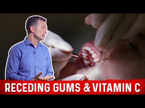 Receding Gums & Vitamin C