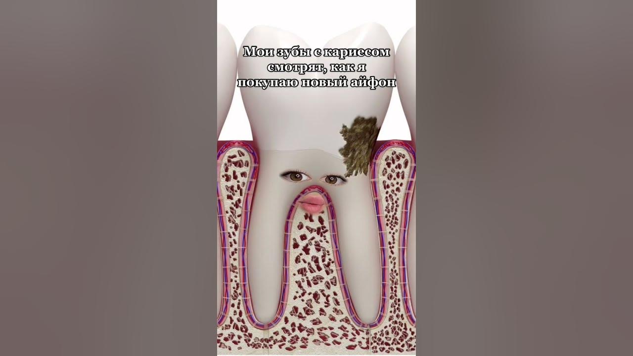 Улыбка джонни деппа 2023. В зубы смотрят odyssey. Несъемный протез на передний зуб. Travis scott гриллзы. Некрасивые улыбки женщин.