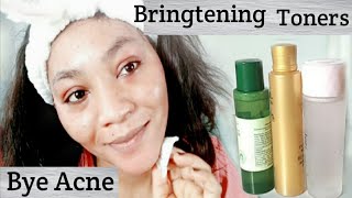 Brightening - 3 BEST Toners For Hyperpigmentation, Dark Spots, Oily + Acne-Prone Skin 2020