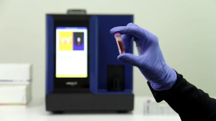 VETSCAN HM5 Hematology Analyzer Demonstration