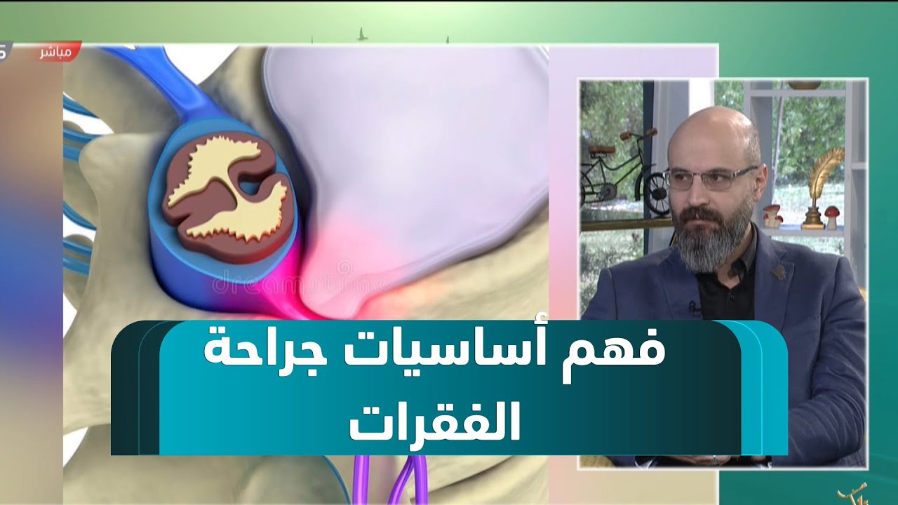 فهم أساسيات جراحة الفقراتضيف نسمات زاكروس: د.سنان الملا - أخصائي جراحة العمود الفقري