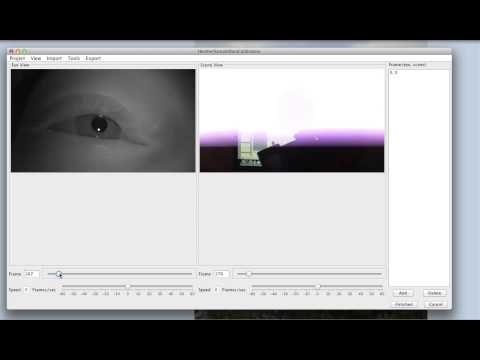ExpertEyes- 2 Sychronize