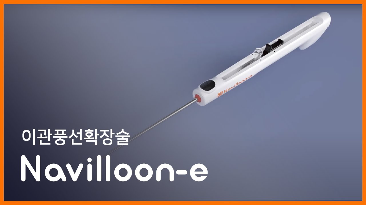 Navilloone Eustachian Tube Balloon Catheter, Mega Medical YouTube